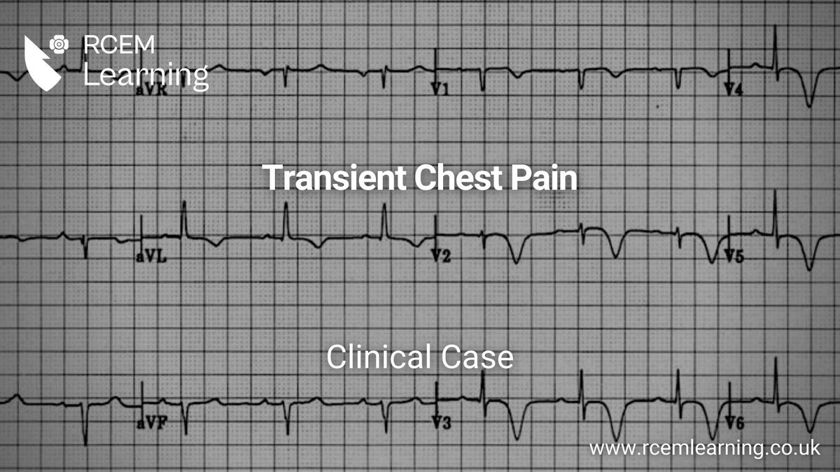 NEW: A 50-year-old man attends the #ED with chest pain that has now resolved. He wants to know if he can go home. Take a look ⬇️ What does the ECG show? 🆓Clinical Case: rcemlearning.co.uk/modules/transi…