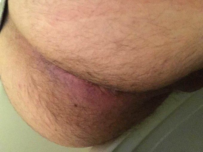 My wet pink asshole, circa 2016 when I was 19 https://t.co/dcDUkUOhLU