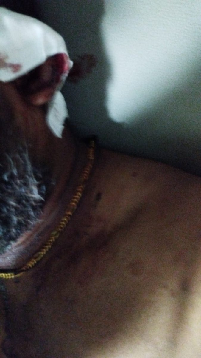 சிவகங்கை மாவட்டம் சிங்கம்புனரி ஒன்றியத்தில் ஐந்துநிலை நாடு என்ற போலியான அமைப்பின் பெயரில் கிருங்காகோட்டையில்  நடத்தபட்ட ஜல்லிகட்டு விழாவில் உரிய கணக்கு வழக்கு விபரம் கேட்டதால் தாசில்தார் அவர்களின் தூண்டுதலின் பெயரில் மாற்று சமுதாயத்தினரால் (மறவர்) தமிழர் தேசம் கட்சி 2/1