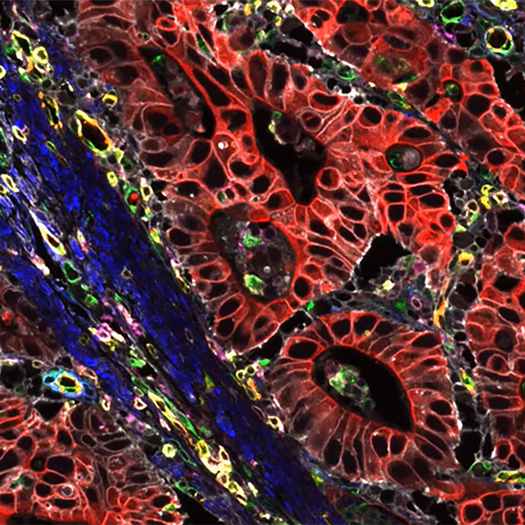 #MultiplexingMonday
✅ Multiplexed imaging is an exciting technique that helps researchers uncover the complex interactions of proteins cell types and microenvironments within human tissue. 
✅ See how #CellDIVE multiplex imaging solution can help you.
👉 fcld.ly/8qfo5cu