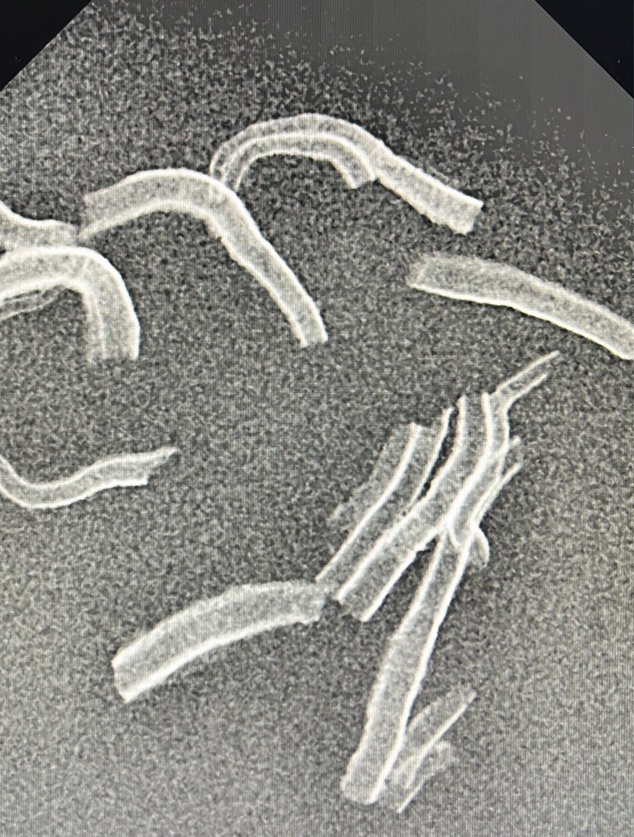 Sicily, Forensic Odontology meets Archeology through digital radiography and 3D scanning. 
🛑 do you want to know what this is? Come to Turin at next <a href="/theAFOHR/">AFOHR</a> Symposium, on the 13th of October scientific paper presentations. 

#forensicodontology
#forensicanthropology