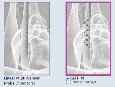 57% of the time linear probes are prone to lateral positioning resulting in
40% of an average esophagus left unmeasured in those cases

NEW S-CATH M: Now visible on 3D cardiac mapping systems. Confident edge-to-edge coverage. #NoMoreLostNSpace

Learn more: hubs.li/Q020qJxr0