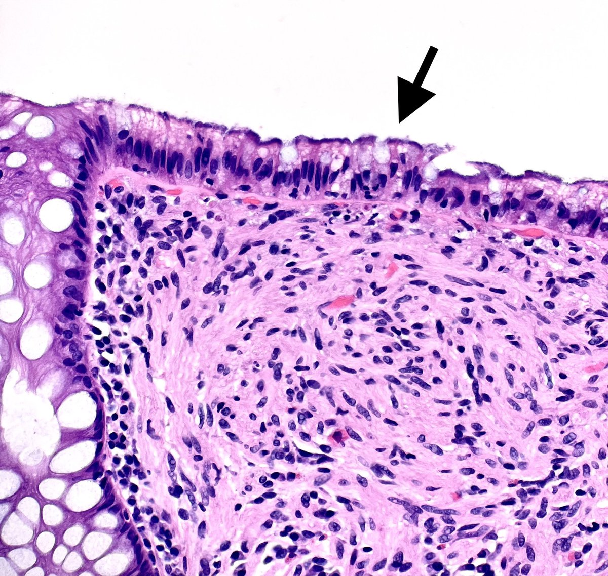 Monika Vyas tweet media