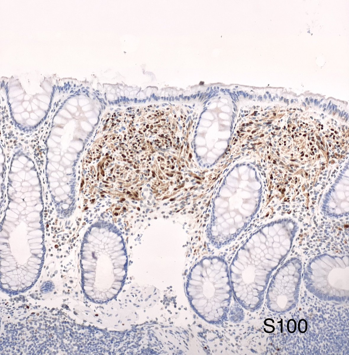 Monika Vyas tweet media