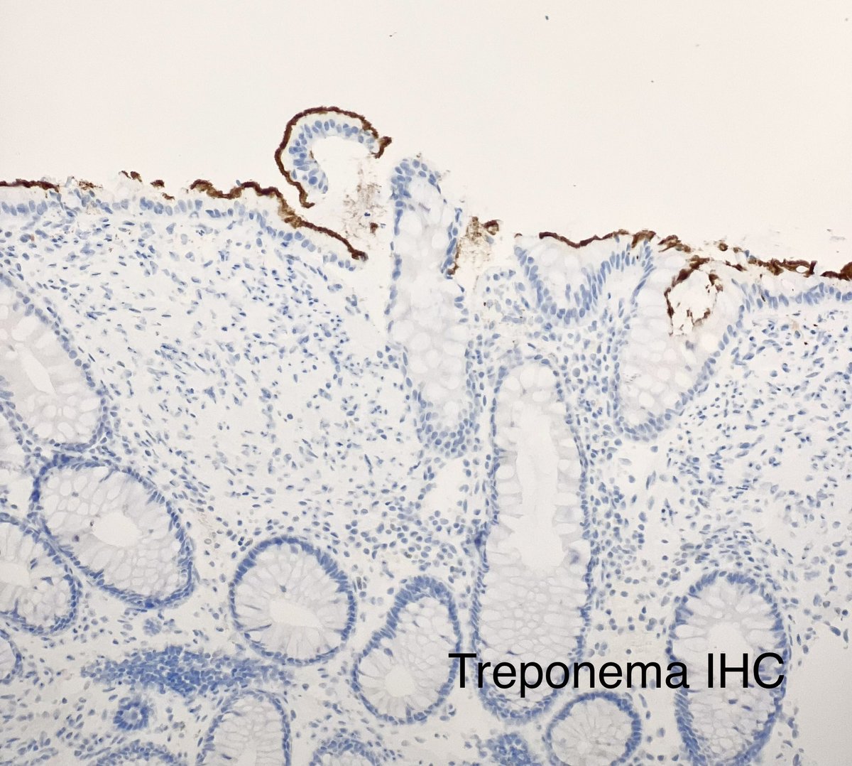 Monika Vyas tweet media