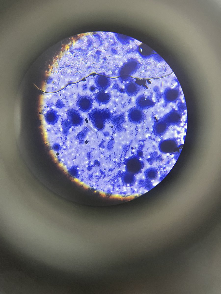 The S6 <a href="/Grove_Academy/">Grove Academy</a> pupils managed to carry out some gram staining of bacteria at @DandAScience .