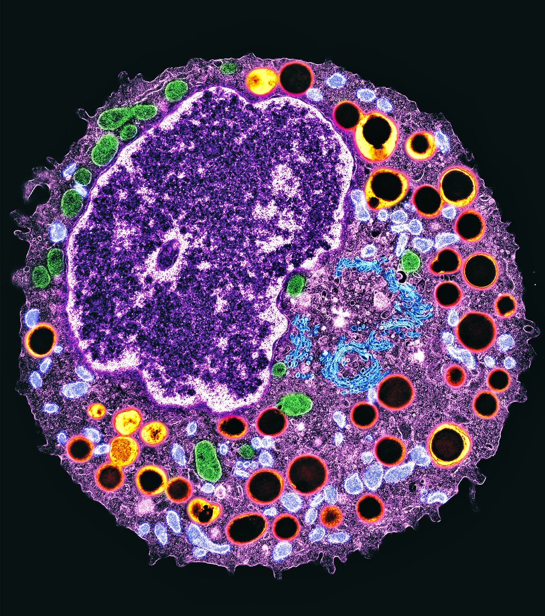 Have you ever seen a human immature #eosinophil  at high resolution?
Here it is one in the middle stage of development captured by electron microscopy.  Learn more in our Atlas: tinyurl.com/ultrastructure
#MicroscopyMonday #sciart