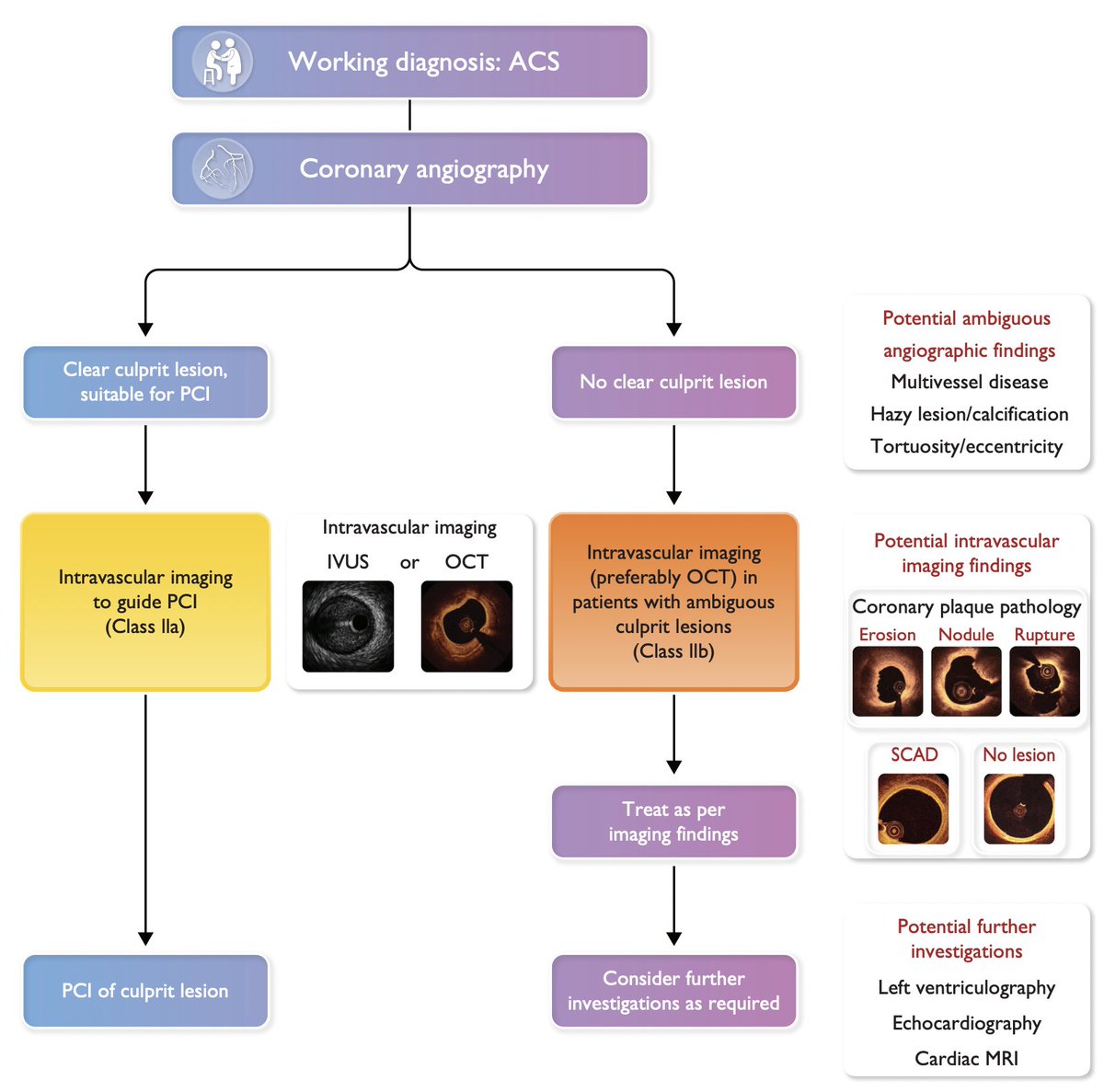1: New recommendations in #ESC2023 ACS Guideline that got my attention.

#IVUS or #OCT should be considered to guide PCI in ACS (Class IIa/A).

If there is no clear culprit lesion, intravascular imaging (preferably OCT) is indicated (Class IIb/C).