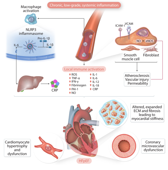 Shining the Spotlight on #HeartFailure at #ESCCongress Explore our latest #HF Spotlight Issue curated by Guest Editors Carolyn Lam, John McMurray, & Thomas Thum, showcasing must-read papers from experts in the field academic.oup.com/cardiovascres/… @escardio #CVD #CardiovascularResearch