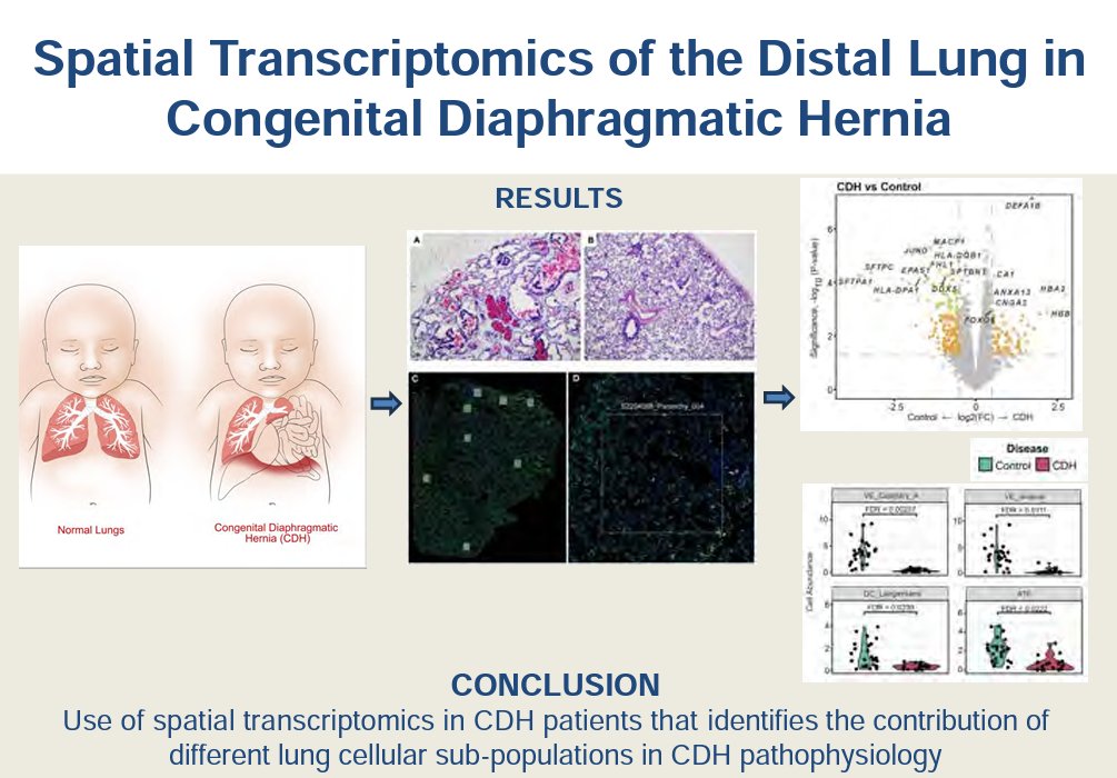 AJP-Lung Cellular and Molecular Physiology (@ajplung) on Twitter photo A large and talented team authored today's #ArticleinPress: Molecular insights using spatial transcriptomics of the distal lung in Congenital Diaphragmatic Hernia (Krithika Lingappan et al.<a href="/ChildrensPhila/">Children's Hospital</a>):
ow.ly/z5j850PEwWA
#TransitionalPhysiology #Hypertension A large and talented team authored today's #ArticleinPress: Molecular insights using spatial transcriptomics of the distal lung in Congenital Diaphragmatic Hernia (Krithika Lingappan et al.<a href="/ChildrensPhila/">Children's Hospital</a>):
ow.ly/z5j850PEwWA
#TransitionalPhysiology #Hypertension