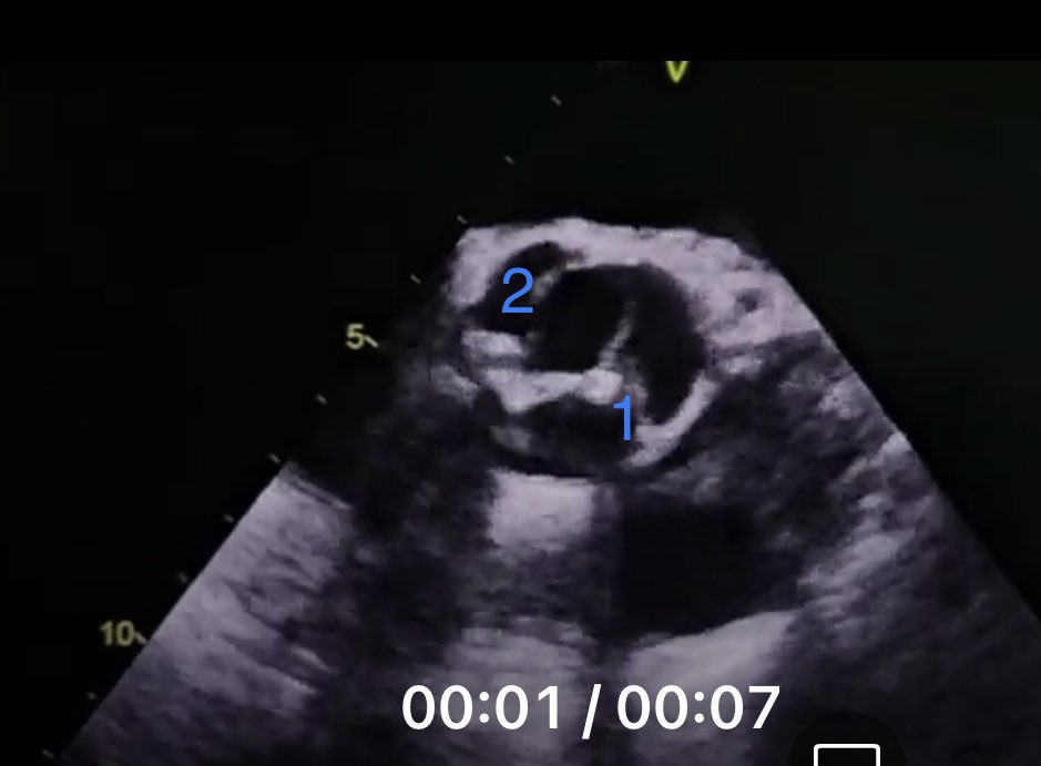 Marcio S M Lima tweet media