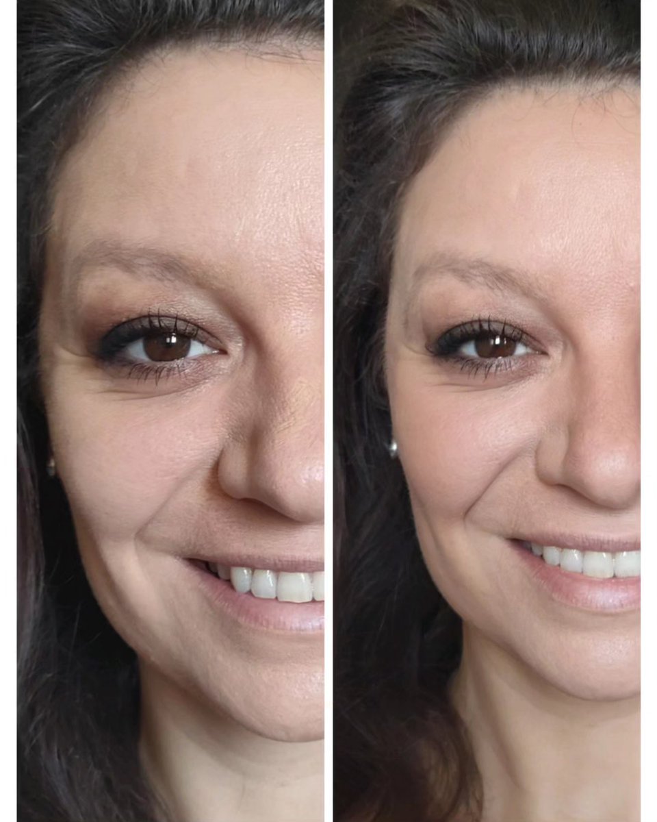 mmeechantillon's tweet image. c'est parti pour 1 mois de test du #kitbonnemine d'#eyecarecosmetics
Merci à @monvanityideal 
Je peux déjà vous montrer la #poudrebronzante.
Ne reste plus qu'à tester :
- le gommage #eclatduteint
-la crème éclat du teint.

#bonnemine #eyecarecosmeticsfrance #eyecareprofessionals