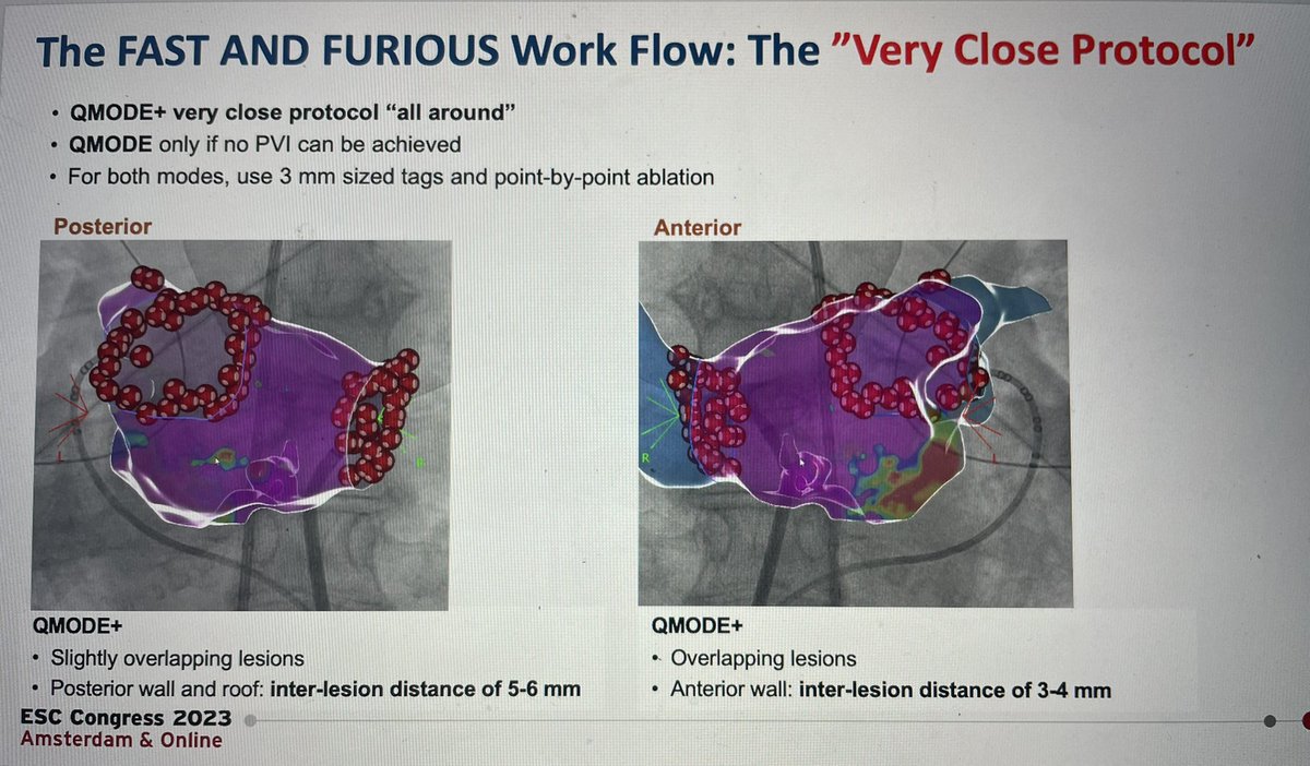 ChristianHeeger's tweet photo. Honored to present our experience on the #QDOT during #DASCAM alumni meeting at #ESC2023.
🙏@AviSabbag @RachelterBekke @escardio and #DASCAM for inviting me.
🔥Are you ready for #vHPSD and #very_close_protocol? 🔥
@RolandTilz @Phiso_de @chris_sohns @SergioConti84 @IdenLeon https://t.co/tTE4ViOAdU