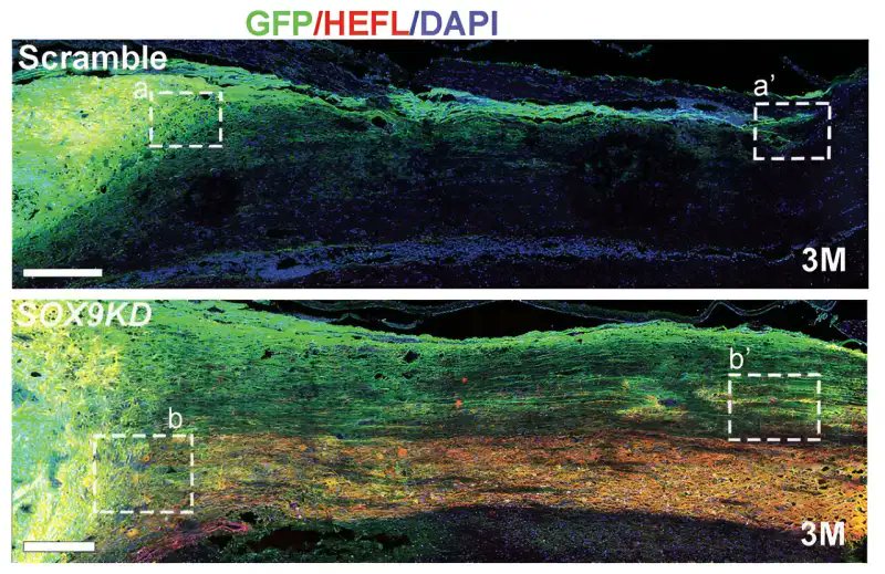 Genetically modified #neuralstemcells show promising therapeutic potential for #spinalcordinjury
#stemcells #regenerativemedicine #medLiber #medLiberpublishinghouse

Visit : bit.ly/3OMloY0