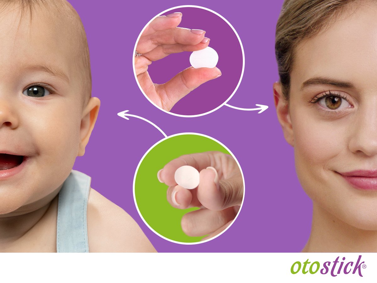 Did you know that Otostick has a baby version?

Otostick Baby serves as a preventative measure for babies and children to help the cartilage and ear develop naturally as your little one grows. 👶

otostick.com

#otostick #preventativecare #ChildrensHealth #earpinning