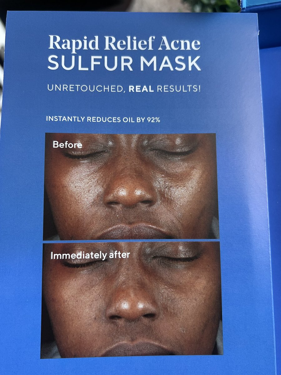 theeeeegemini's tweet photo. #presssample New drop from @MuradSkincare: Rapid Relief Acne Sulfur Mask $44
https://t.co/6ofqtuqqdG https://t.co/6KAjFnpedg