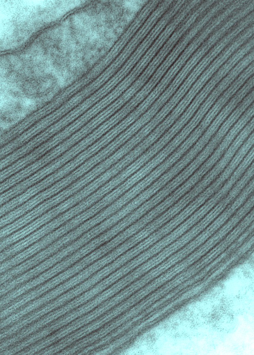 LeoAndrade1974's tweet image. Myelin sheath is a multilamellar spiral of cell membrane around an axon, consisting of alternating major dense and two intraperiod lines. Several diseases and conditions, such as multiple sclerosis, degrade myelin compromising the optimal electrical signal. #electronmicroscopy