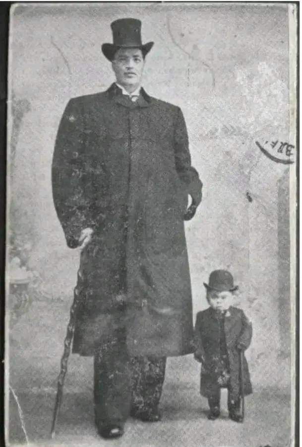 NALISSAMEBO01's tweet photo. Do you know 

Adam Rainer, the only person in history to have lived as a dwarf and a giant in one lifetime. 

At 18, Reiner was a dwarf, standing at 4'8.3'' inches tall. https://t.co/KE4JJIXN4i