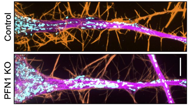 Hot from the #preprint!

Former colleague <a href="/CisternaBA/">Bruno</a> now @ Vitriol's lab @chillinwithpfn1) show in #neurons &amp; CAD cells how profilin 1 (PFN1) regulates actin (orange) &amp; myo, which changes microtubules (magenta) &amp; #mitochondria (cyan) distribution

Truce in the #CytoskeletonWars?