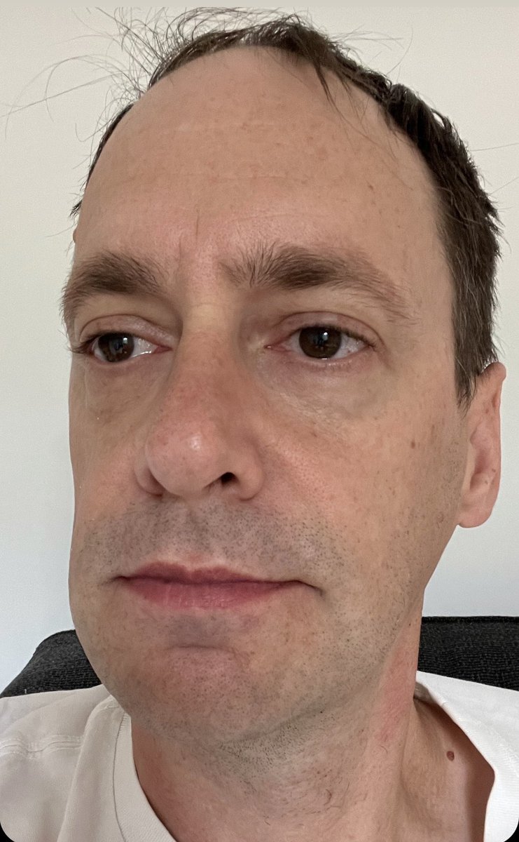 alistair green tweet media