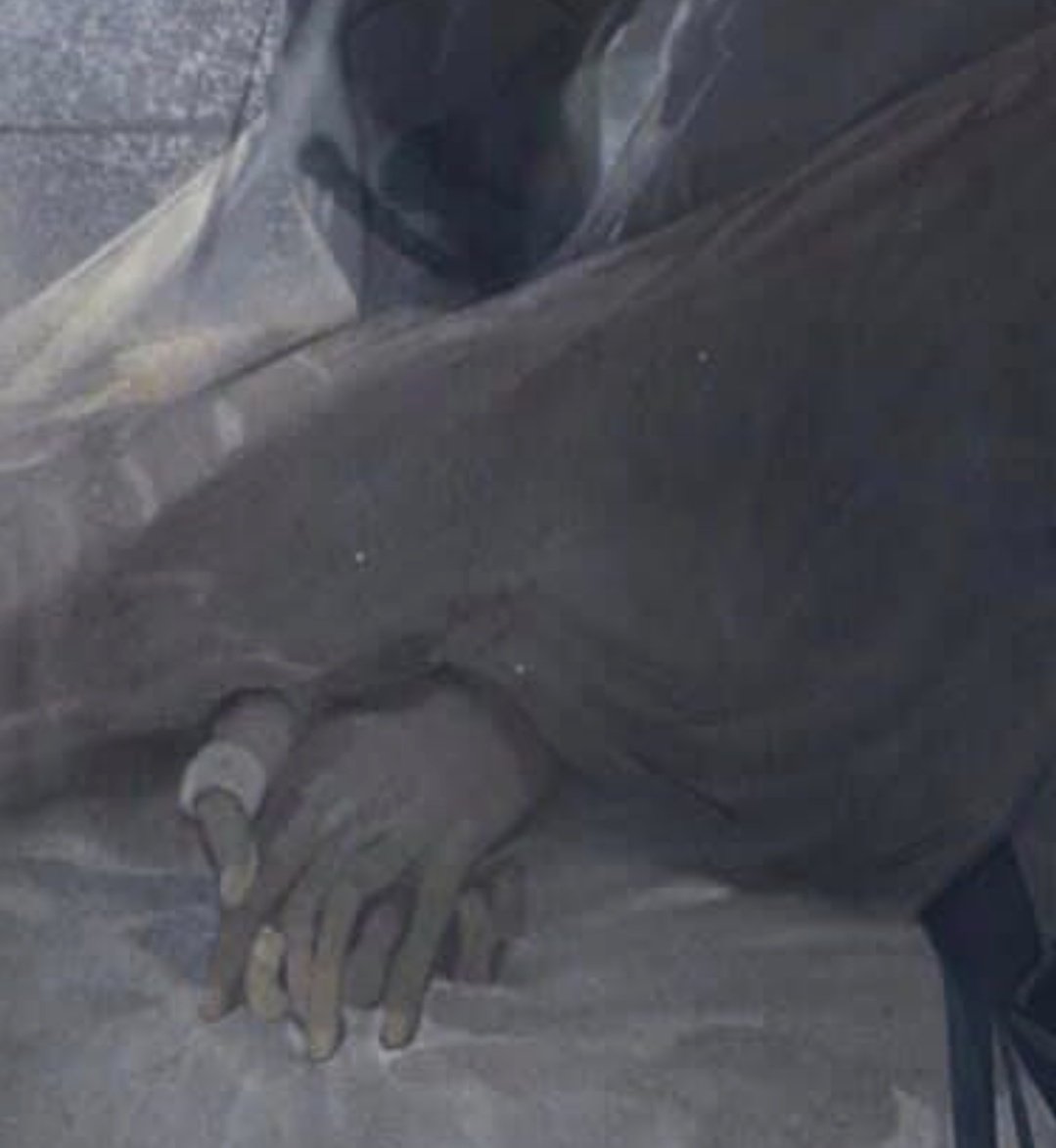 15_centimeters's tweet photo. the wounds on his hands from digging in the ditches....but he doesn't care bc lanzhou needed him. Who else frew up https://t.co/S0oDGMXTyx