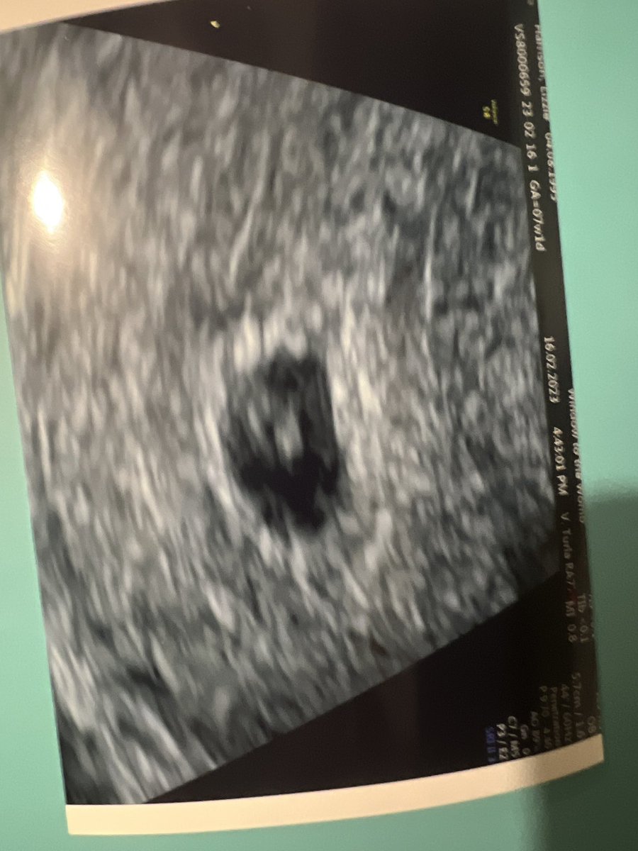 _lizziesarah's tweet photo. Two due dates will pass with empty arms. Our first teeny tiny bean would be weeks away from arriving. Nothing makes this easier. 😔 https://t.co/foZvD5c4IK