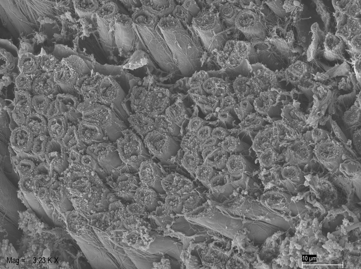LeoAndrade1974's tweet image. Myelin sheath is a multilamellar spiral of cell membrane around an axon, consisting of alternating major dense and two intraperiod lines. Several diseases and conditions, such as multiple sclerosis, degrade myelin compromising the optimal electrical signal. #electronmicroscopy