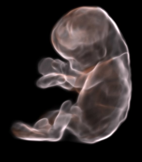 ¿Qué el equipo de ultrasonido hace todo?…

La neta es que es una combinación de varios factores:

Talento
Obsesión
Buen gusto.

Ojalá que el render del ultrasonido saliera limpiecito.

#fetal #ultrasonido #radiologia