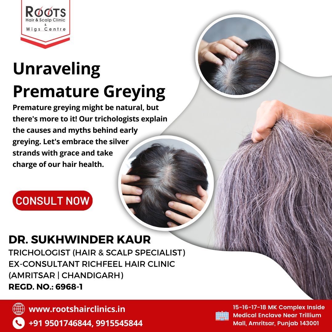 'Embracing Natural Beauty  Unraveling the mystery behind premature greying! 

📱 : 9501746844

🌎Visit: rootshairclinics.in

#Rootshairscalpclinic #Drsukhwinderkaur #NaturalBeauty #RootHairCare #PrematureGreyingSolutions #HairPigmentation