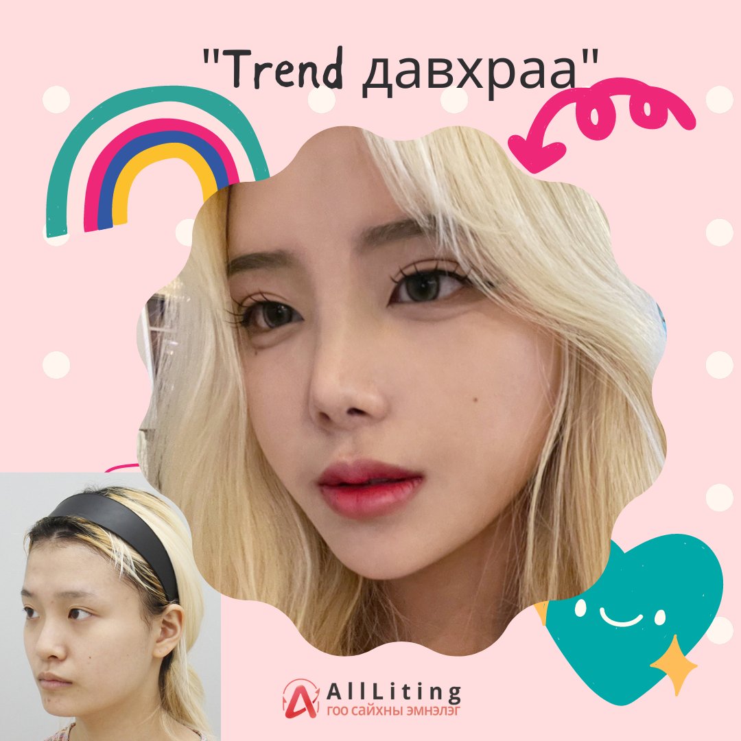 📷📷📷#TREND #ДАВХРАА 📷📷📷
хийлгэсэн мэс ажилбар
📷зүсэлтгүй давхраа /ДАВТАН/
-------------------------------
📷📷 ҮЗЛЭГ/ЗӨВЛӨГӨӨ үнэгүй хийж зөвхөн таньд тохирсон мэс заслын төлөвлөгөөг гаргана.
📷монгол ажилтан: 010-4931-4451