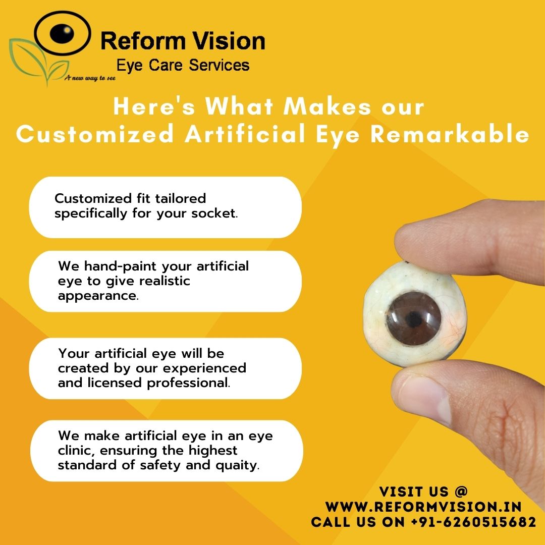 Our ocularists are artesian and customising an artificial eye for those who have lost their eye to trauma, infections etc. is an art.
#artificialeyeservices #artificialeyeclinic #artificialeyehyderabad #eye #prostheticeye #prostheticeyes #ocularprosthesis #customizedartificialeye