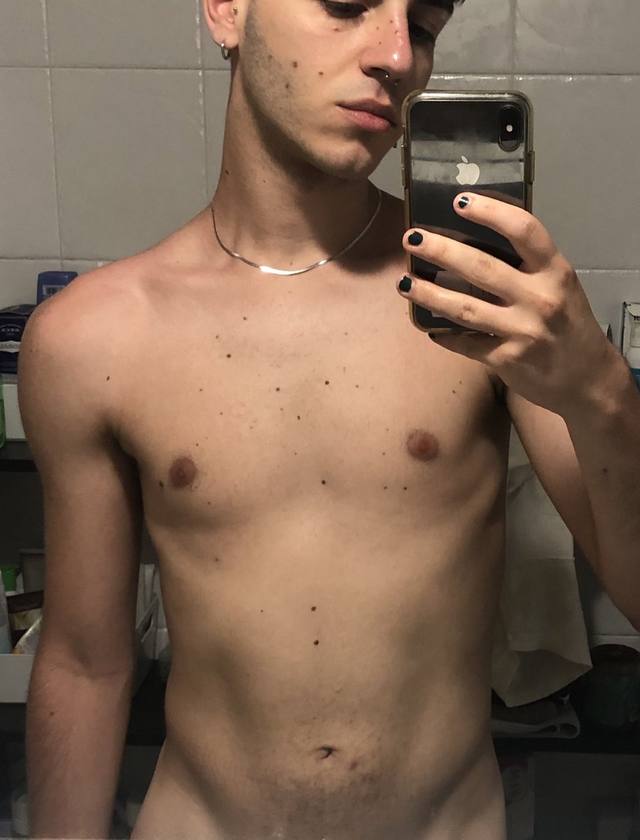 ultimamente mi arrivano apprezzamenti per i miei nei