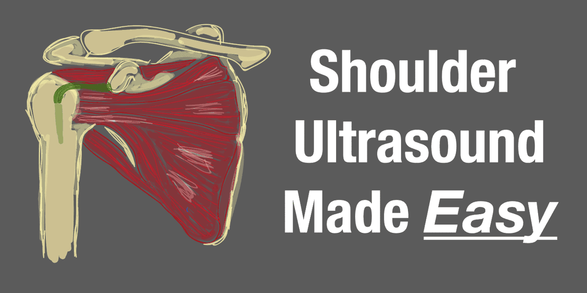 PracticalPOCUS's tweet photo. One step at a time makes shoulder ultrasound easy! In this article, Pocus101 uses the ASAP method to guide shoulder POCUS...
https://t.co/WOaMlBt6PS
#shoulderPOCUS #Pocus101 #ASAPmethod #ultrasound https://t.co/zSNFWfT6jl