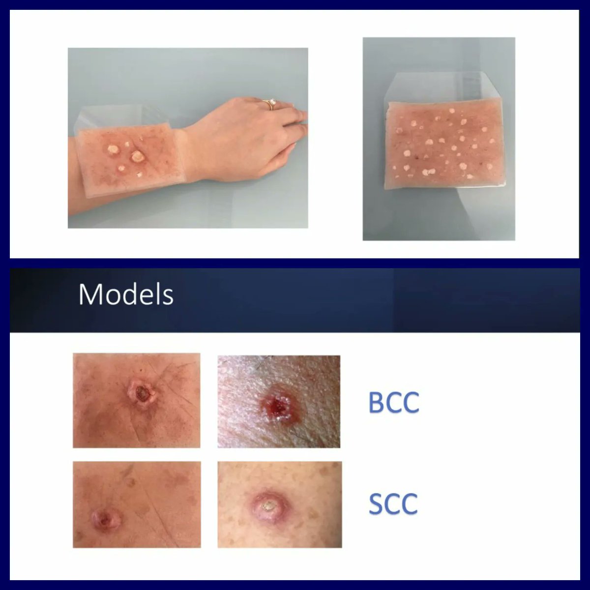 There was an exciting discussion about simulation teaching in dermatology on #AMEE2023. The similarity between natural skin and the simulated material is impressive! As a complementary education could be a really good option!