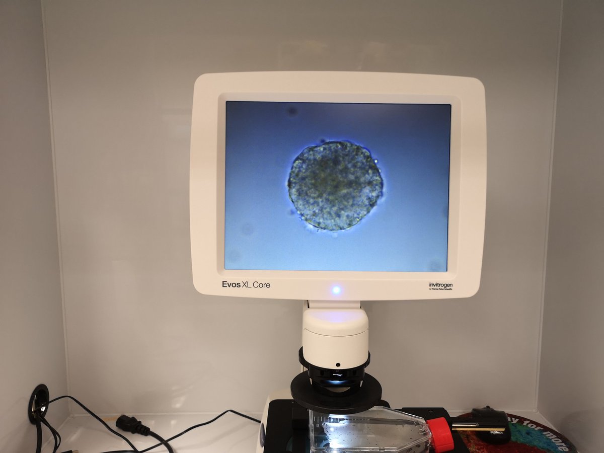 Thepurplelilac's tweet photo. To start organoid differentiation, maintenance medium will gradually be replaced with neural induction medium. During a period of 7 days, embryonic stem cells will start to form floating spheres called "embryoid bodies"
#science #stemcells #embryonicstemcells #vision #research https://t.co/GE3KFYA8cs
