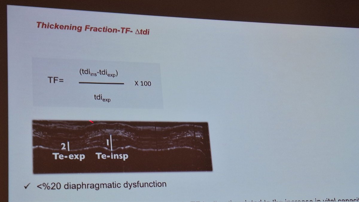 Diafragmatic failure If thickening factor is less then 20% 
#POCUS
<a href="/wicc2023/">WICC2023</a> 
Presentation of Dr Huseyin Arıkan