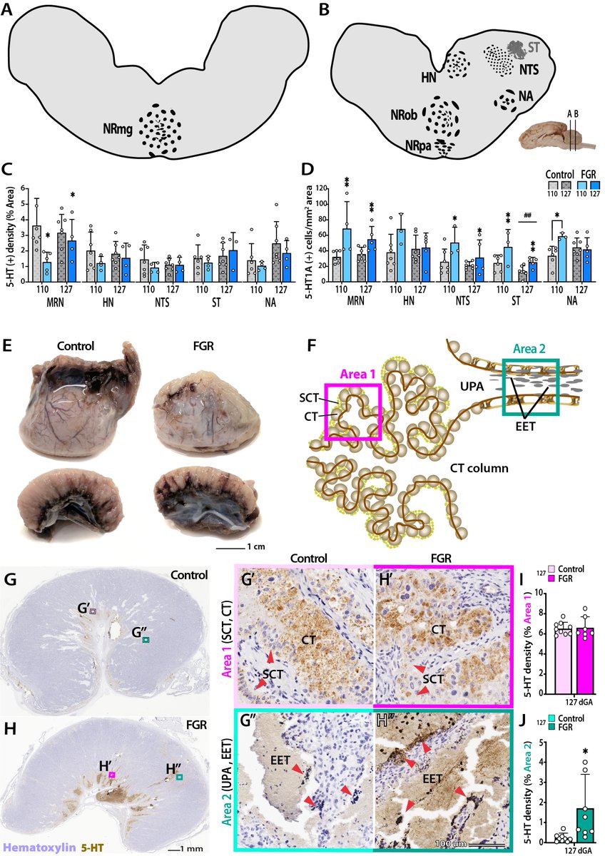 Our new groundbreaking paper shows chronic hypoxia disrupts #brainstem serotonergic centres controlling #cardiorespiratory functions. Unlocking potential insights into the implications for fetal/infant conditions of a similar nature ...#SIDS? <a href="/JPhysiol/">Journal of Physiology</a> 

doi.org/10.1113/JP2849…