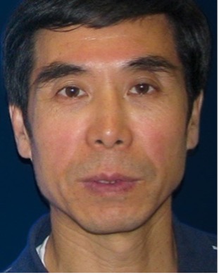 NEIDirector's tweet photo. Wenxin Ma &amp; @Wei_Li_Vision from the @NatEyeInstitute’s Retinal Neurophysiology Section transplanted human microglia cells into mouse retina to create a model for testing treatments for eye diseases like #AMD.

@TMichaelRedmon1

@eLife preprint (reviewed): https://t.co/QjkH7vLmQO https://t.co/sQW6wEMs0l