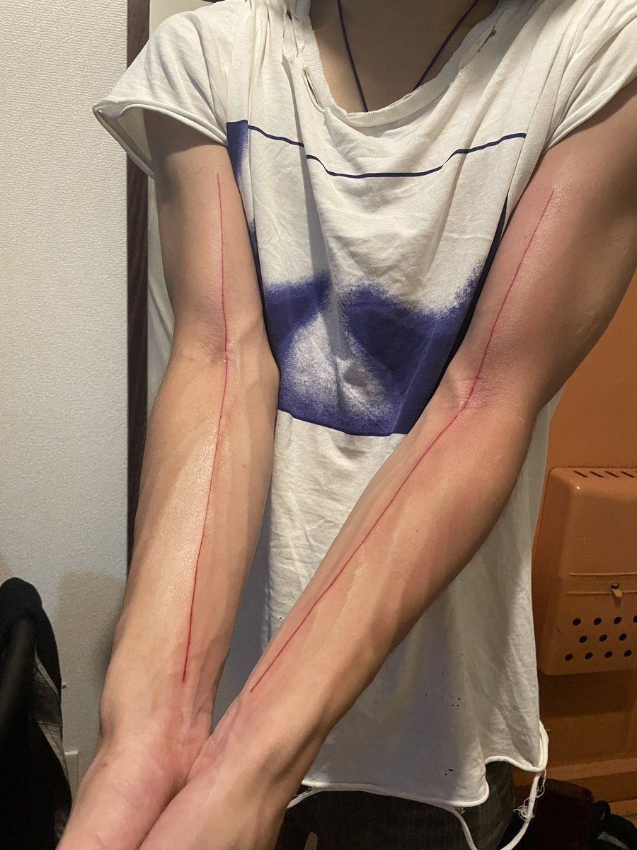 前の日に急に気持ちが変わって、両腕に一本の線にした
23歳、ブレるな軸的な
かなり気に入ってる、めちゃくちゃ