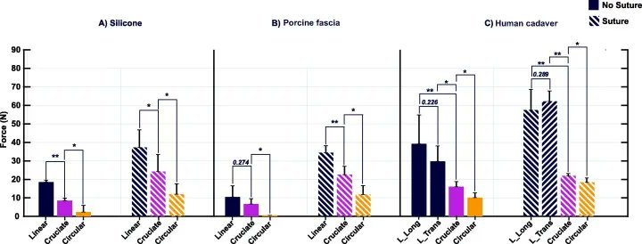 European Urology Open Science (@eururolopen) on Twitter photo Assessment of Urostomy Parastomal Herniation Forces Using Incisional Prevention Strategies with an Abdominal Fascia Model
buff.ly/3OQxAXE
@KDibo900 <a href="/yashusxdcr/">Yashwanth Nanda Kumar</a> <a href="/schadegr/">George R Schade</a>
#UroSoMe #Openaccess #Openscience Assessment of Urostomy Parastomal Herniation Forces Using Incisional Prevention Strategies with an Abdominal Fascia Model
buff.ly/3OQxAXE
@KDibo900 <a href="/yashusxdcr/">Yashwanth Nanda Kumar</a> <a href="/schadegr/">George R Schade</a>
#UroSoMe #Openaccess #Openscience