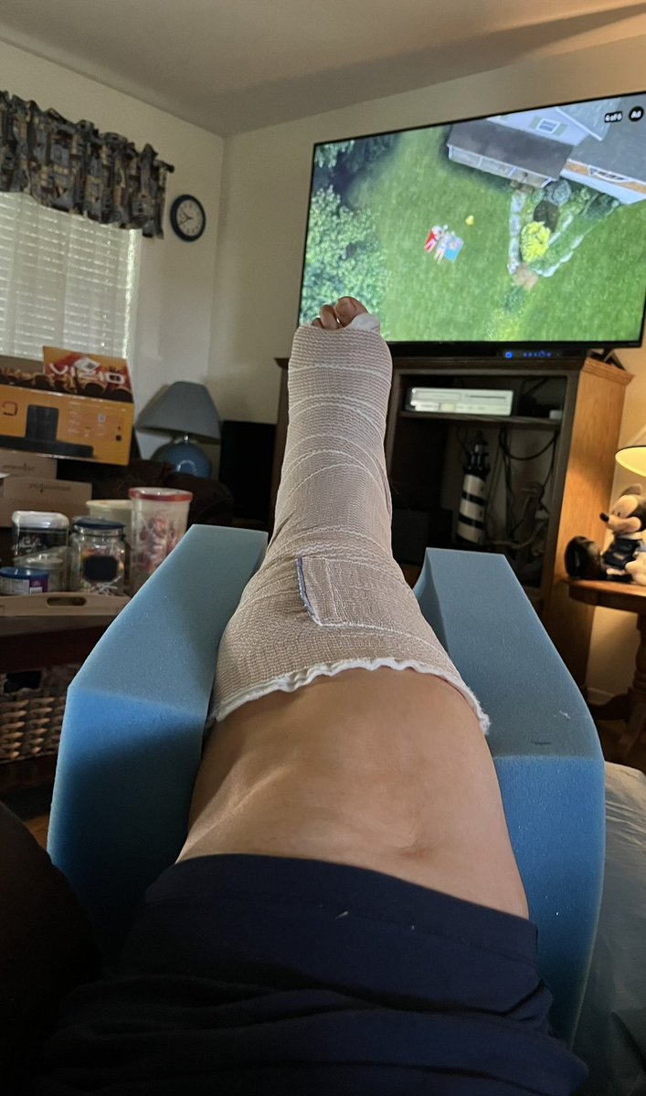 #teachersoftwitter #clearthelist @ArtTeacherLife7 <a href="/SchoolSW0406/">SchoolSW0406 🚀🏳️‍🌈🌻💙</a>
I am home from surgery and doing well. Everything went smooth. I cannot put any weight on the foot. Thankfully I practiced before surgery.  Extreme arm workout.  I am not allowed to go back to school until Sept 8.