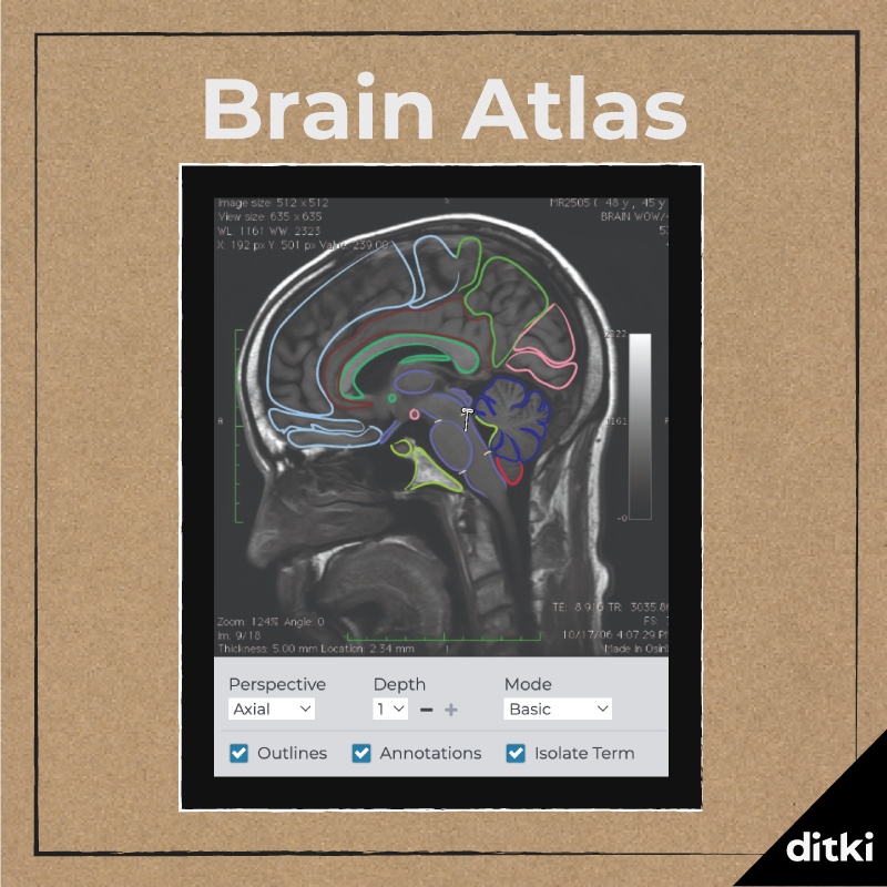 If you're studying Neuroanatomy or Neuroscience this fall, Ditki is a must-have! 

Learn more: l8r.it/OD9t

#ditki #neuro #neurology #neuroCME #RITE #ABPN #neuroresidency #neuroprogram #neurolibrary #neuroed #usmle #meded #medstudent 
#nursing #physicianassistant