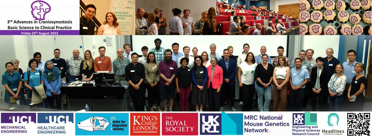 Mehran Moazen (@mehran_moazen) on Twitter photo A huge thanks to all colleagues, friends and funding bodies for contributing to 3rd Advances in #craniosynostosis <a href="/KarenJLiu/">Prof Karen J Liu</a> <a href="/kilcoyne_sarah/">Sarah Kilcoyne</a> <a href="/becky_tooze/">Rebecca Tooze</a> <a href="/Wilkie_Lab/">Wilkie Lab</a> <a href="/Wills_Barrell/">Wills Barrell</a> <a href="/tischfield/">Max Tischfield</a> <a href="/SarahMcKaig2/">Sarah McKaig</a> <a href="/moazenlab/">Moazen Lab</a> <a href="/Health_Eng/">UCL Institute of Healthcare Engineering</a> <a href="/CIA_UCL/">UCL Centre for Integrative Anatomy</a> <a href="/HeadlinesCranio/">Headlines Craniofacial Support</a> & Prof Morriss-Kay A huge thanks to all colleagues, friends and funding bodies for contributing to 3rd Advances in #craniosynostosis <a href="/KarenJLiu/">Prof Karen J Liu</a> <a href="/kilcoyne_sarah/">Sarah Kilcoyne</a> <a href="/becky_tooze/">Rebecca Tooze</a> <a href="/Wilkie_Lab/">Wilkie Lab</a> <a href="/Wills_Barrell/">Wills Barrell</a> <a href="/tischfield/">Max Tischfield</a> <a href="/SarahMcKaig2/">Sarah McKaig</a> <a href="/moazenlab/">Moazen Lab</a> <a href="/Health_Eng/">UCL Institute of Healthcare Engineering</a> <a href="/CIA_UCL/">UCL Centre for Integrative Anatomy</a> <a href="/HeadlinesCranio/">Headlines Craniofacial Support</a> & Prof Morriss-Kay