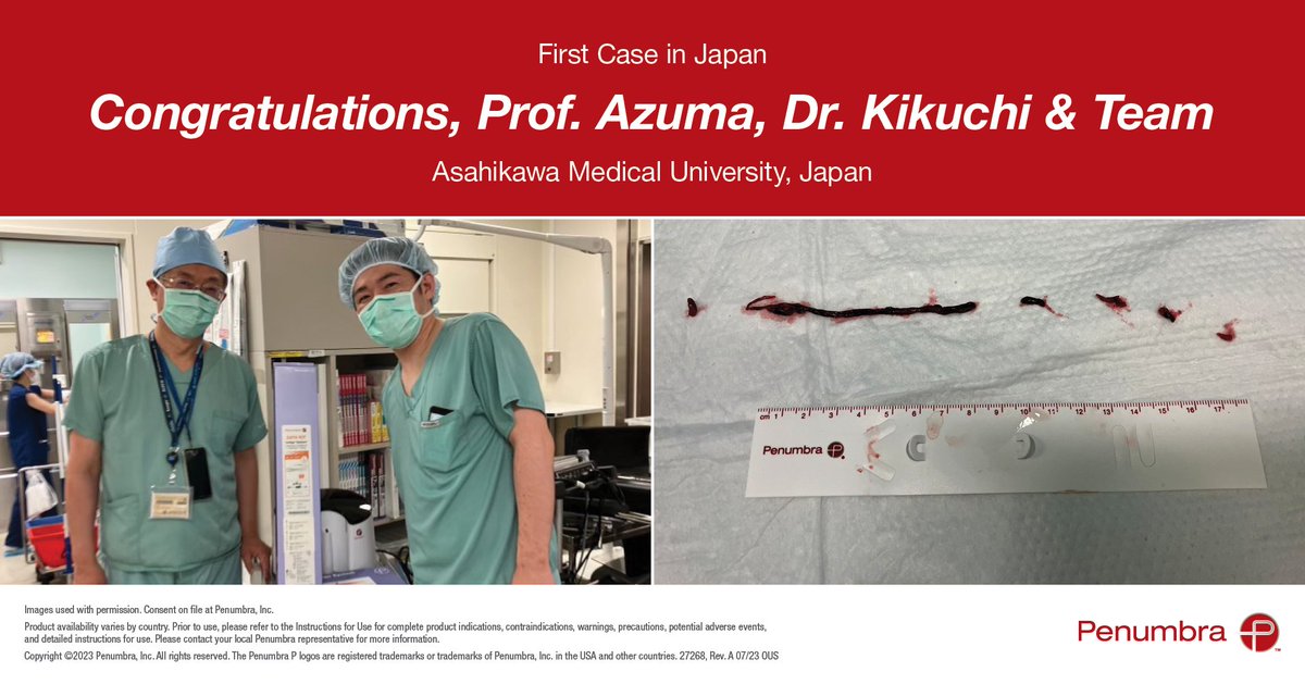 PenVascular's tweet photo. OUS HCPs: Congrats Prof. Azuma & Dr. Kikuchi at Asahikawa Medical Univ for 1st MT case w/ #IndigoSystem for #ALI in Japan. Prof. Azuma said, "Indigo System is effective & a very useful tool for ALI BTK.” Rx only. For risk info: https://t.co/wrIewhqVk5 Clinical results may vary. https://t.co/1bS6PpQBcs