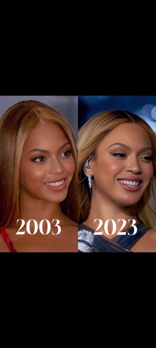 Beyonce Before And After Skin Beyoncé Before And After