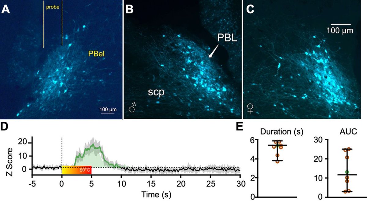 SfNJournals's tweet photo. #JNeurosci: @jessesmith587 et al. @AsafKeller @um_neurobio developed a method to record the activity of neurons in the parabrachial nucleus in behaving mice. The findings shed light on the cellular mechanisms of chronic pain and conditioned aversion. https://t.co/KucBbgfE1P https://t.co/Ltfgy32GKo