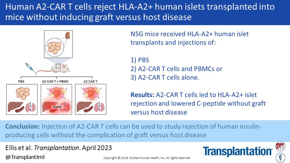Transplantation (@transplantjrnl) on Twitter photo In this study in the current issue of <a href="/TransplantJrnl/">Transplantation</a>, <a href="/mklevings/">Megan Levings</a> et al. describe a novel mouse model for studying human islet rejection while avoiding xenograft-versus-host disease. #VisualAbstract #TransplantTwitter bit.ly/3squG4i In this study in the current issue of <a href="/TransplantJrnl/">Transplantation</a>, <a href="/mklevings/">Megan Levings</a> et al. describe a novel mouse model for studying human islet rejection while avoiding xenograft-versus-host disease. #VisualAbstract #TransplantTwitter bit.ly/3squG4i