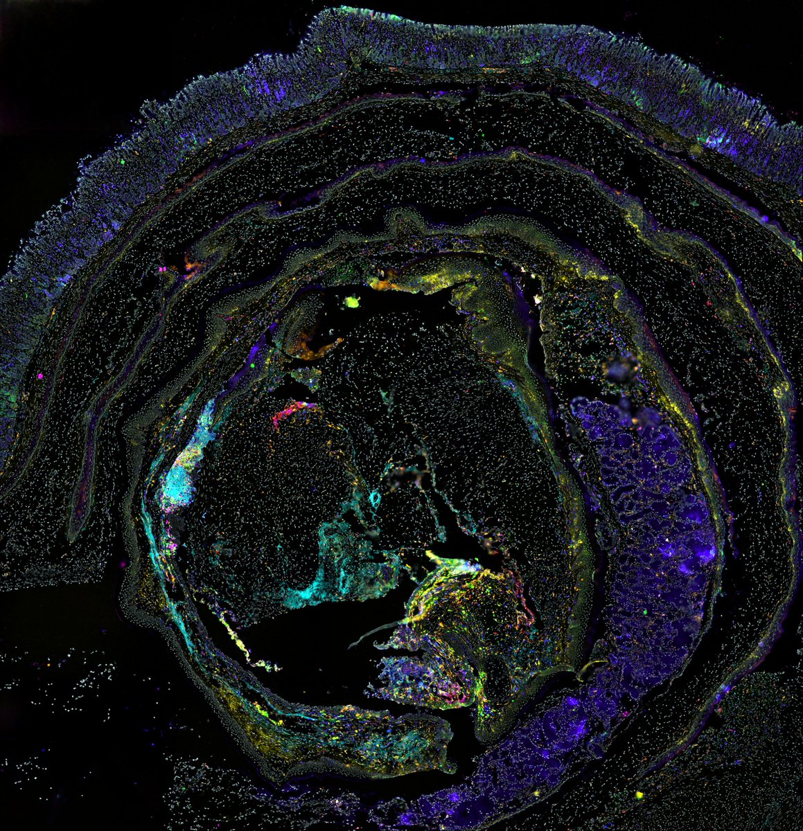 Introducing, the ORES roll! Or as @gamonasterioo likes to call it, 🇨🇱 'Brazo de Reina' 🇨🇱 ! Interested? Todays the last day to register for Gustavo’s webinar tomorrow! Register here!: lnkd.in/dxN-zd6q #Biotechnology #cancerresearch #spatialbiology #techonology