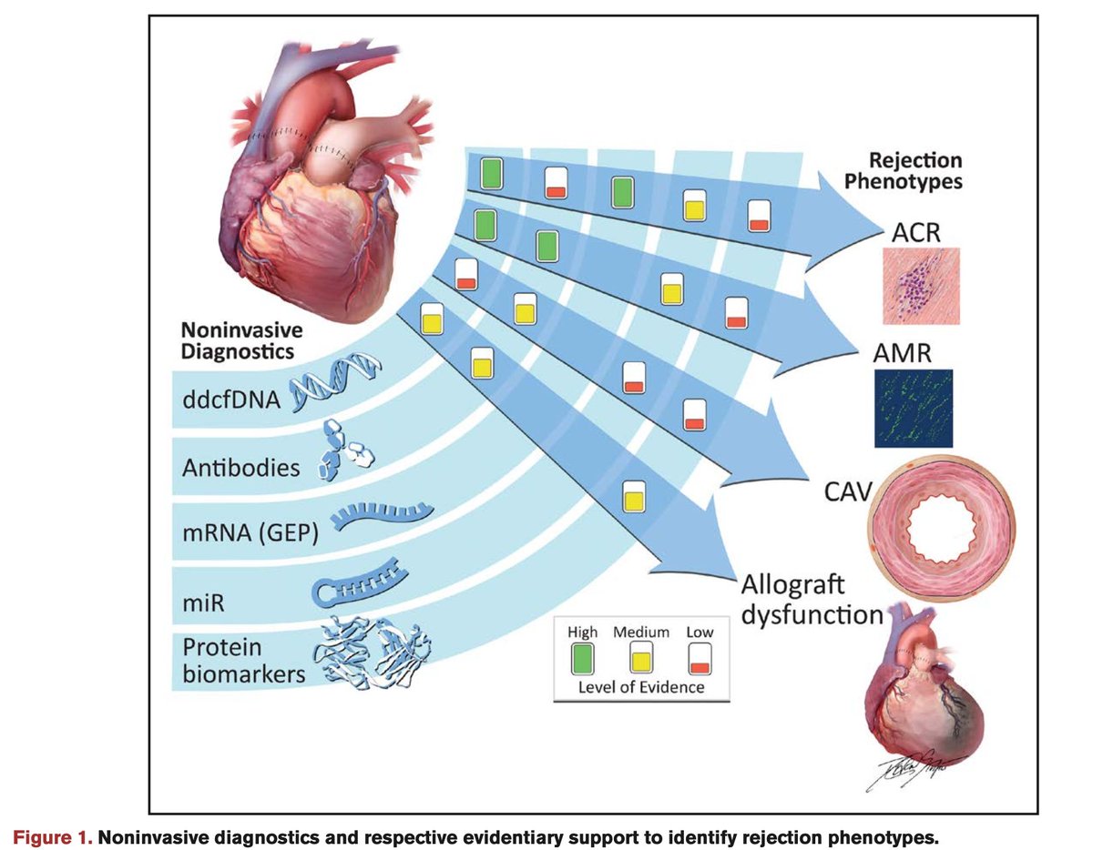 #Tweetorial (1 of 6) dd-cfDNA has significant evidence in diagnosing ACR and AMR. GEP can diagnose ACR only, and HLA antibodies are associated with AMR. More data needed for MicroRNA and Proteomics and in CAV. @PalakShahMD @laurentrubymd @Annette_HLA @KiranKhush1 @AgborOmicsLab