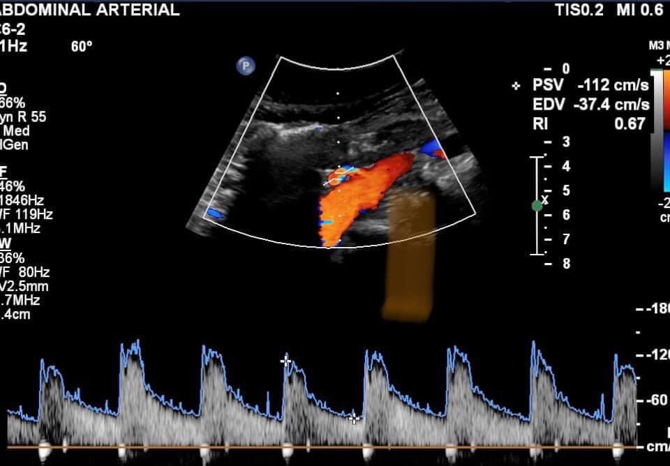 Marcos A. P. Borges, MD 🇧🇷 tweet media